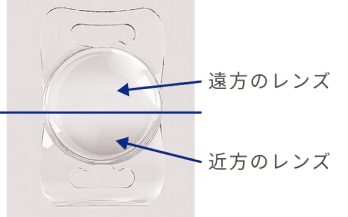 2焦点眼内レンズ（選定療養または保険適応）