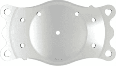 IPCL (Implantable Phakic Contact Lens)